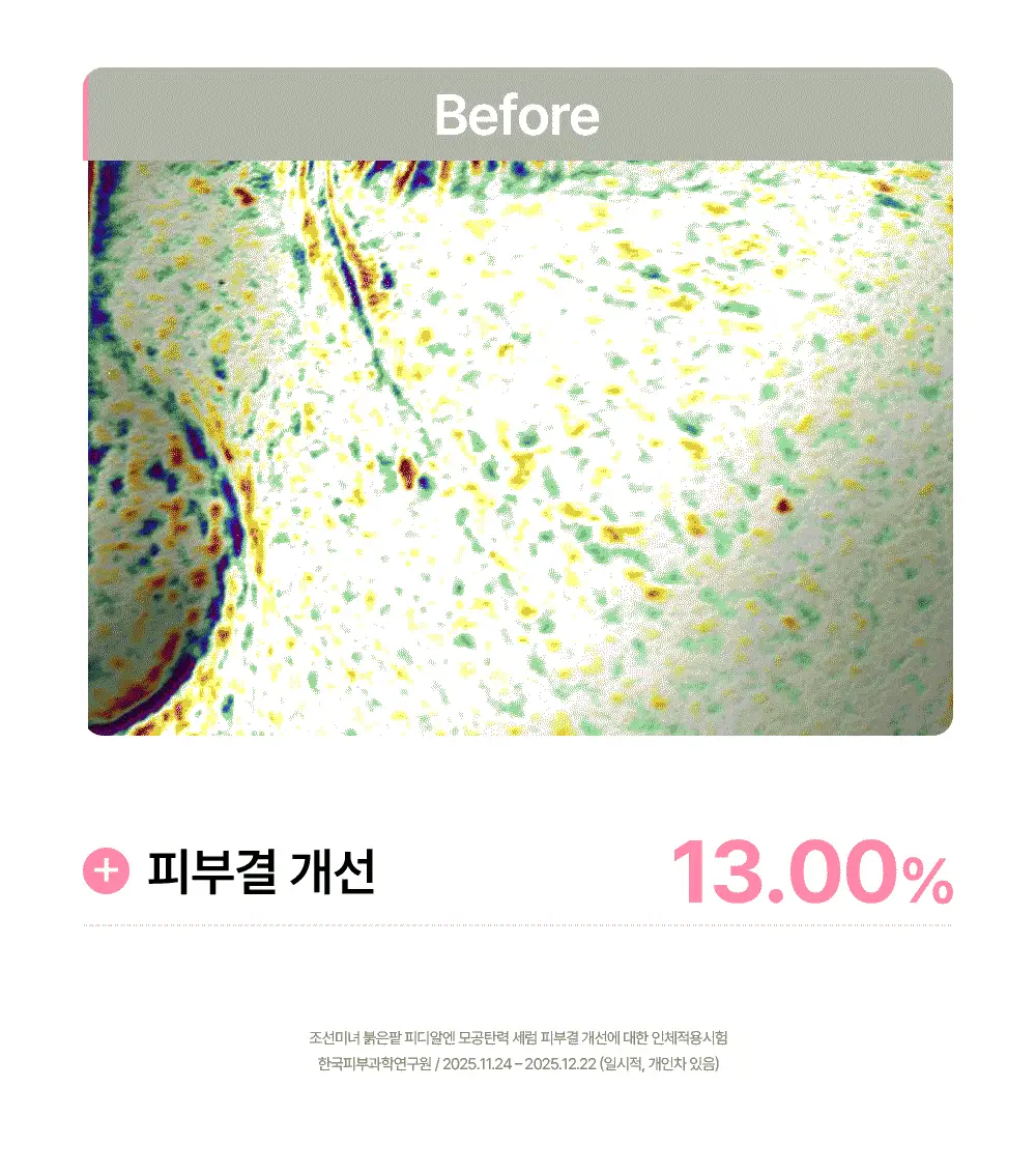 [단독/붓기완화] 조선미녀 붉은팥 PDRN 모공탄력 세럼 30ml 더블기획 상세페이지 30